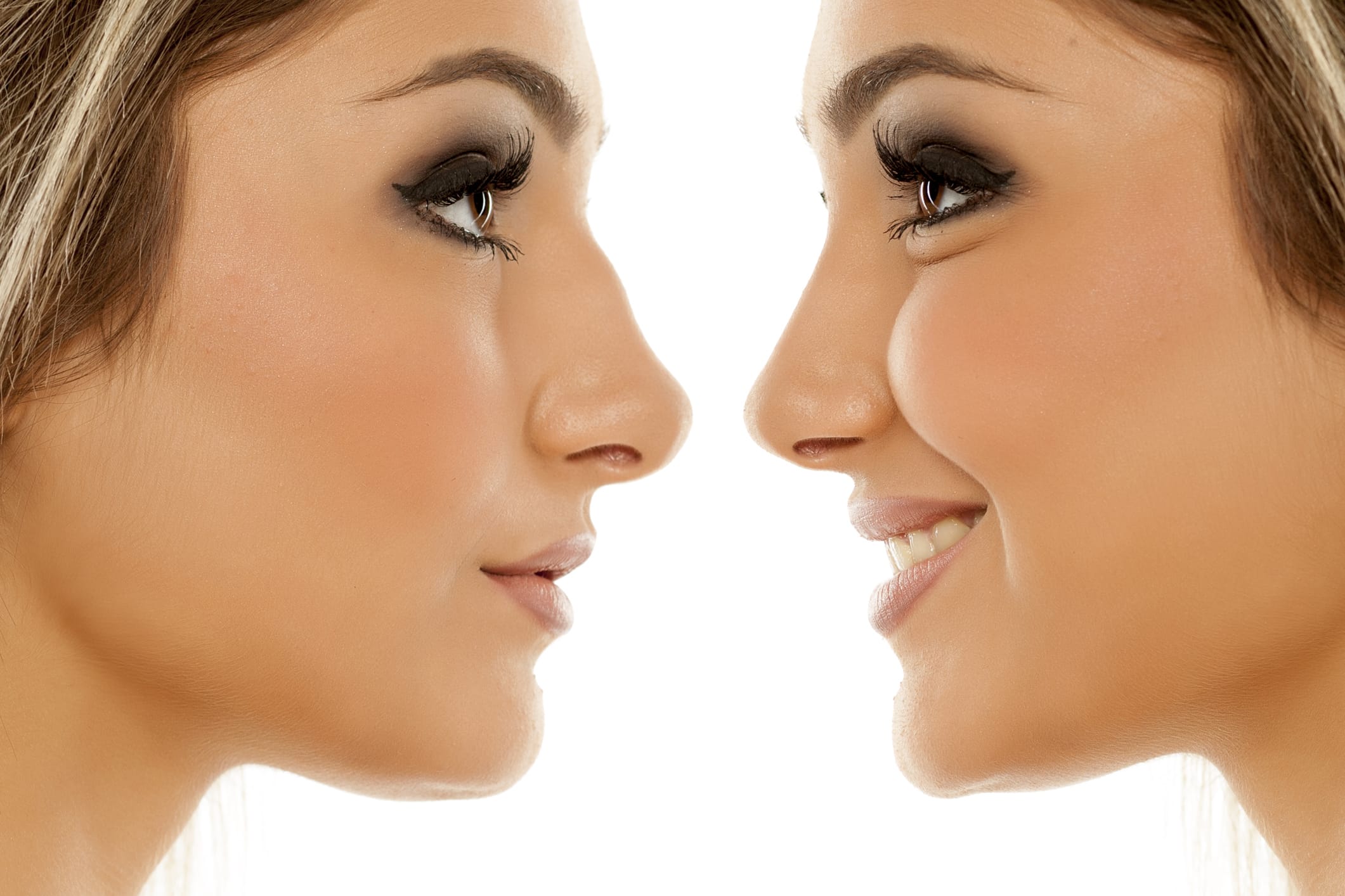 rhinoplasty | Hilton Head Island, South Carolina