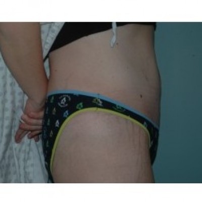 After Image